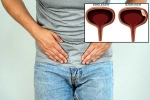 Bladder Cancer symptoms, Bladder Cancer, why is bladder cancer common in men, Unhealthy eating habits