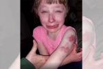 girl, Lilly, 10 year old special needs child brutally bitten on arm while returning home in school bus, Special needs