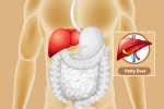 Fatty Liver problems, Fatty Liver lifestyle changes, dangers of fatty liver, Development