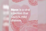mpox in Africa, mpox in Congo, mpox emergency again, Sweden