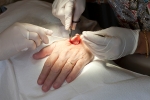 skin patch cancer treatment, pictures of skin cancer, cancer treatment can now be pain free, Liver cancer