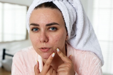 This Drink may help Get Rid of Stubborn Pimples
