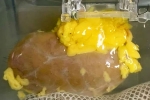 Universal Kidney Scientists, Universal Kidney latest, scientists develop universal kidney transplanted to any blood group, Take 20