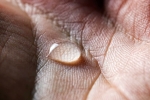 Ways To Treat Sweaty Hands And Feet, 10 Ways To Treat Sweaty Hands And Feet, 10 ways to treat sweaty hands and feet, Tea bags
