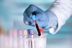 researchers, AB8, researchers discover an antibody that can cure covid 19 what is it, Ab8