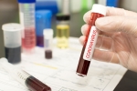COVID-19, COVID-19, covid 19 vaccine likely by 2021 who, Hydroxychloroquine COVID-19, COVID-19, covid 19 vaccine likely by 2021 who, Hydroxychloroquine