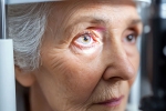 Glaucoma eye disease, Glaucoma experts, all about the eye disease glaucoma, Glaucoma